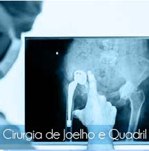 cirurgia-joelho-quadril